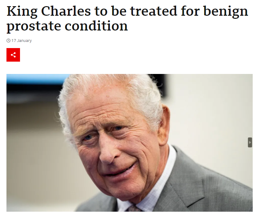 A screenshot of the BBC website. The headline reads "King Charles to be treated for benign prostate condition." There is a photo of King Charles III beneath.